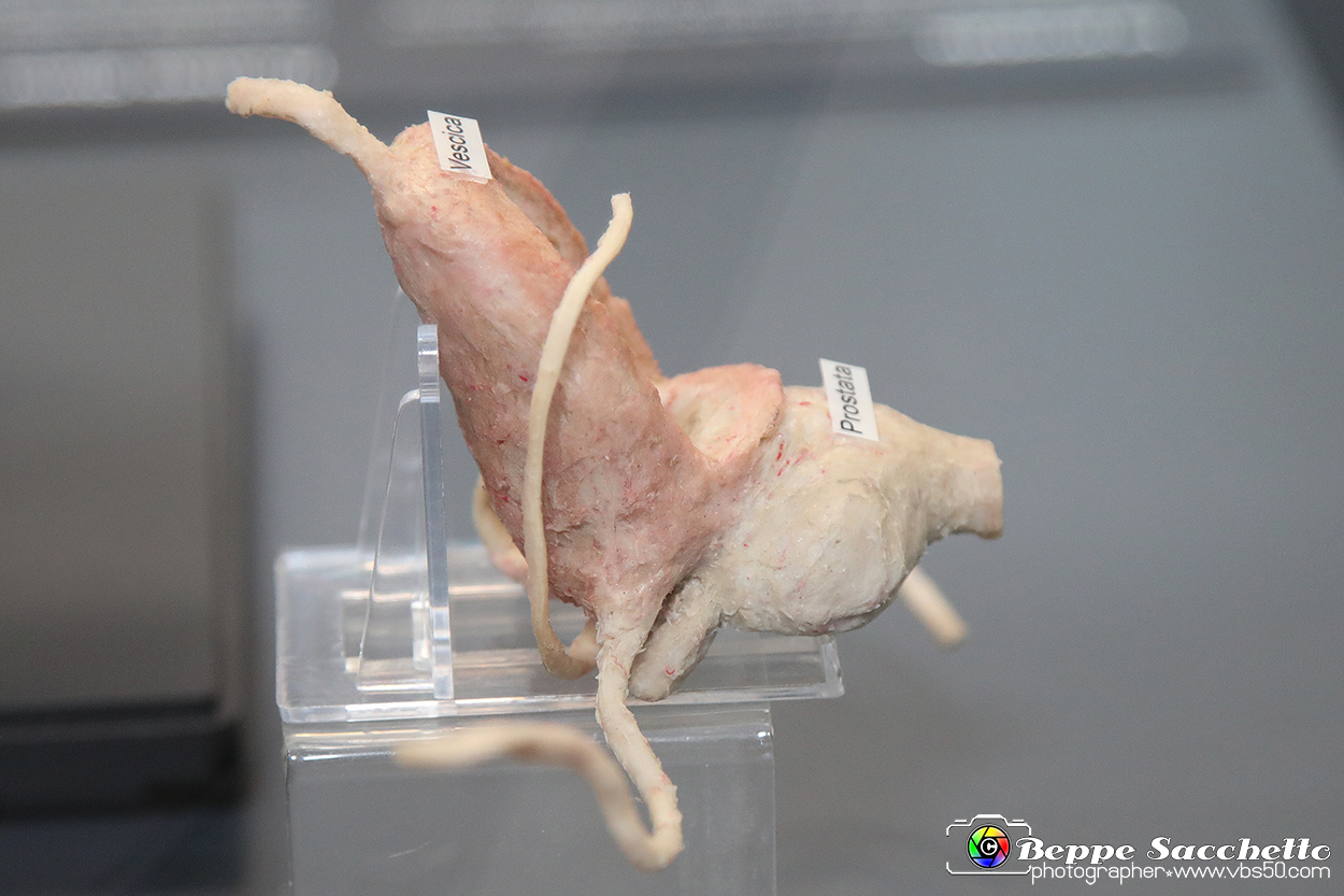 VBS_2568 - Prostata - Mostra Body Worlds.jpg